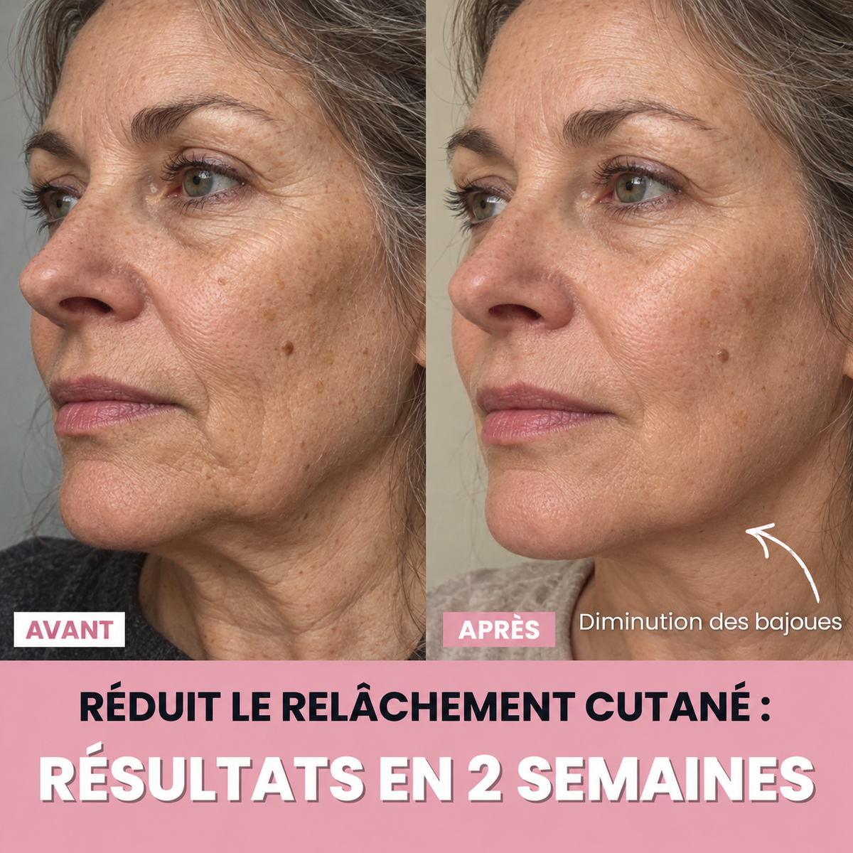 Aube™ : Sculpteur facial LED 7 en 1