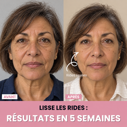 Aube™ : Sculpteur facial LED 7 en 1